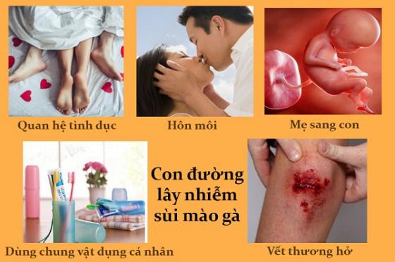 lay_nhiem_sui_mao_ga-1 (1).jpg