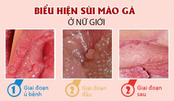 sui-mao-ga-nu-1.jpg