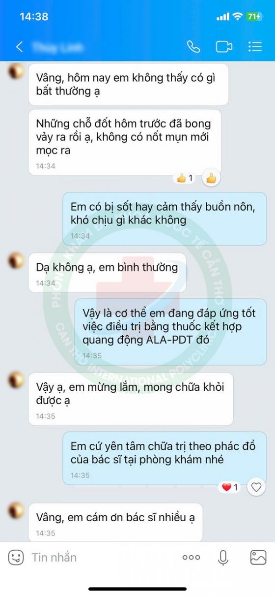 mụn rộp4.jpg