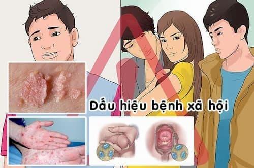 Benh-xa-hoi.jpg