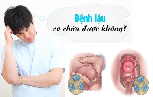 chua-benh-lau-tai-nha.jpg